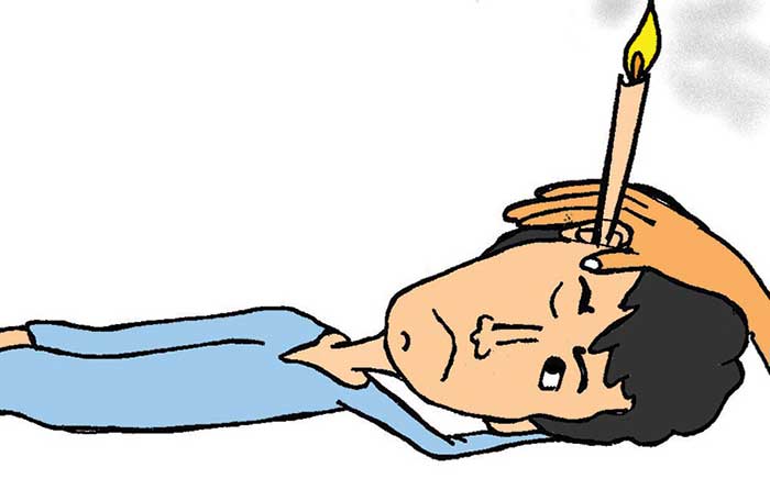 Illustration of man getting his ears cleaned with a candle